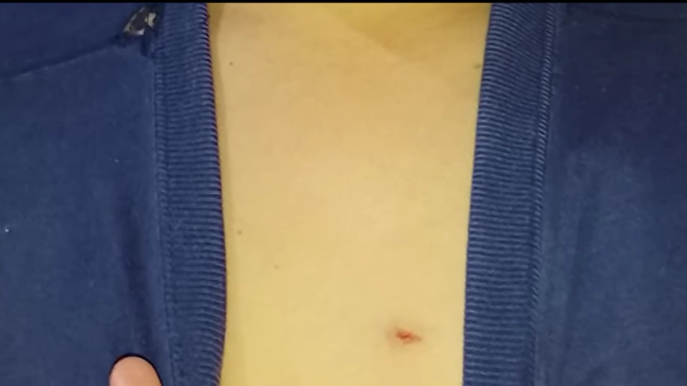 Violencia escolar: un alumno de 10 años sufrió un puntazo con una tijera en el pecho en una escuela de la zona oeste | Rosario y la región