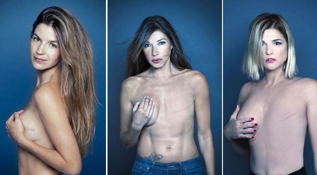 #PonerleElPecho: la impactante campaña de famosas contra el cáncer de mama | Espectáculos