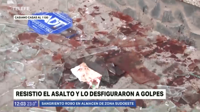Un comerciante se resistió a un asalto y lo desfiguraron a golpes | Información General