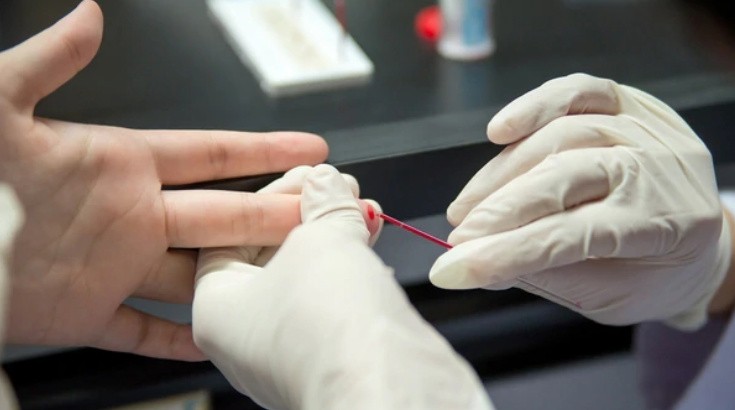 Realizarán pruebas gratuitas de detección de HIV | Información General