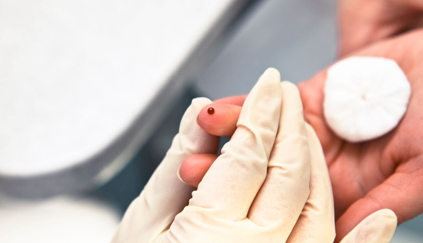 Realizarán pruebas gratuitas para la detección Hepatitis C | Información General