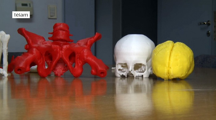 Adelanto en la Fundación Favaloro: operaron por primera vez con un órgano impreso en 3D como referencia | Tecnología