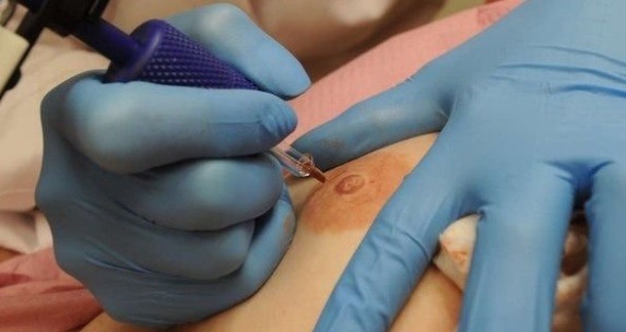 Por su propia historia decidió tatuar gratis pezones a las mujeres que sobreviven al cáncer | Información General