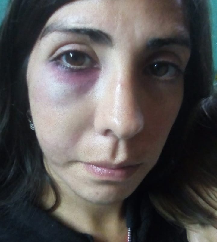 Su novio la golpeó, perdió un embarazo y murió: la lucha de la familia para que reconozcan el femicidio | Información General