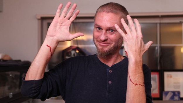 Un joven que se dejó morder por 200 serpientes venenosas en busca del antídoto universal | Tecnología