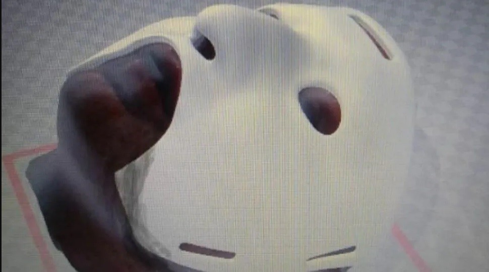 Cirujanos argentinos crearon una máscara 3D para reconstrucción facial en casos de quemaduras profundas | Información General