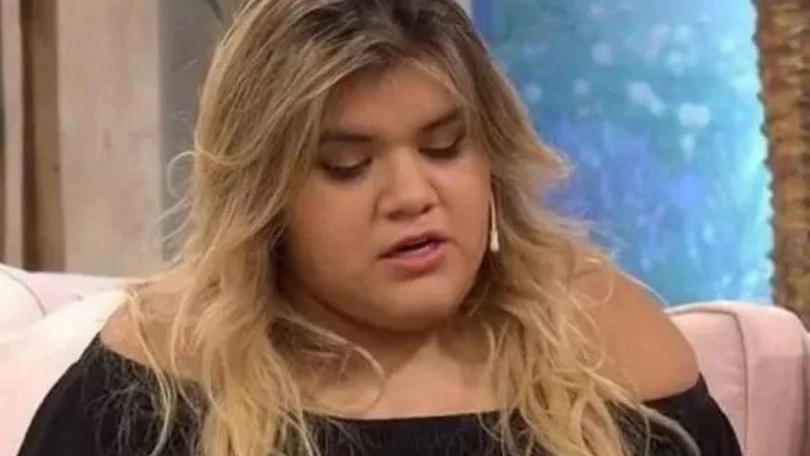 More Rial mostró el nuevo retoque estético que se hizo en la cara | Espectáculos