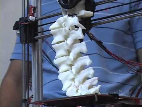 Científicos argentinos desarrollan "huesos" con impresoras 3D que el cuerpo absorbe en forma natural | Información General