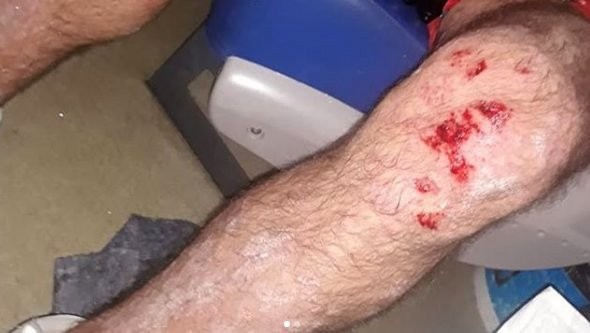 Salvaje ataque homofóbico a una pareja en el barrio porteño de Villa Urquiza | Información General