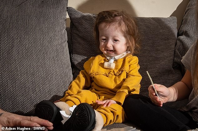 El calvario de la nena de 2 años que sufre "la enfermedad de Benjamin Button" | Internacionales