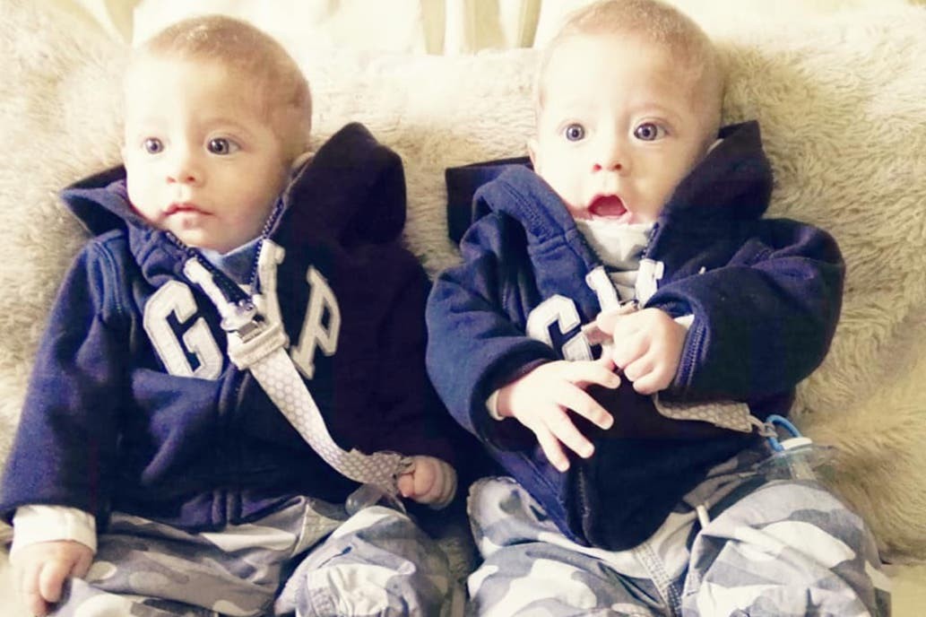 Realizarán el primer trasplante simultáneo a gemelos en Argentina | Información General