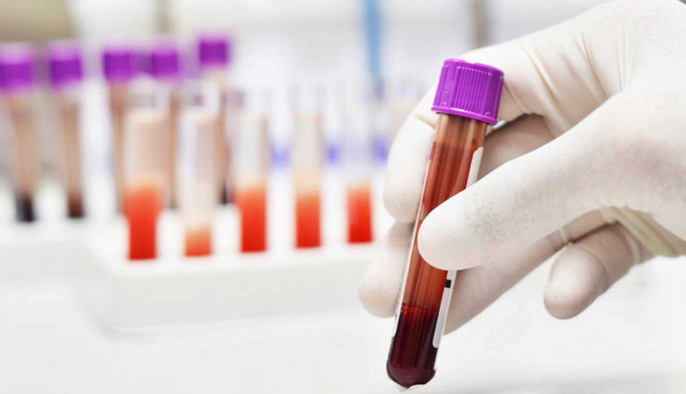 Absolvieron a los directivos de la Fundación de la Hemofilia por el contagio masivo de VIH y hepatitis C | Información General