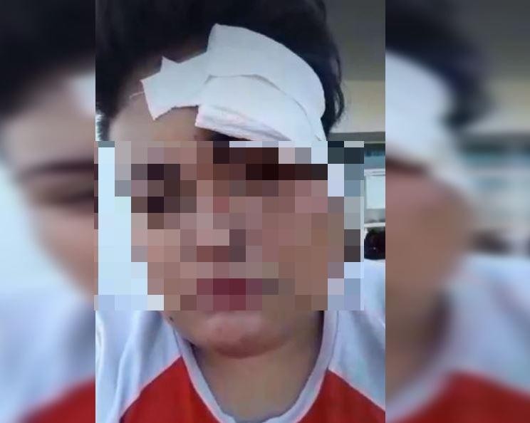 Ataque lesbofóbico: una mujer fue golpeada a la salida de un boliche por cinco hombres | Información General