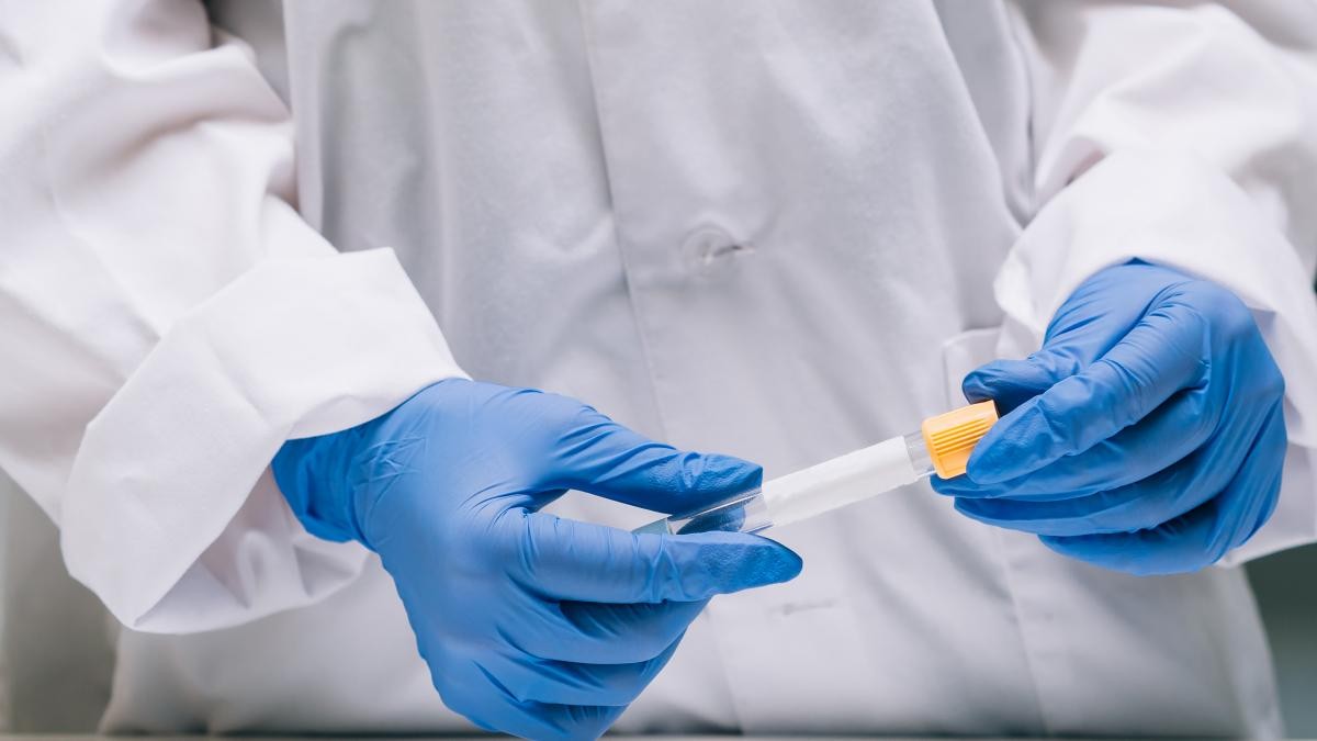 Importante avance en Argentina en el desarrollo de pruebas rápidas para detectar COVID-19 | Información General