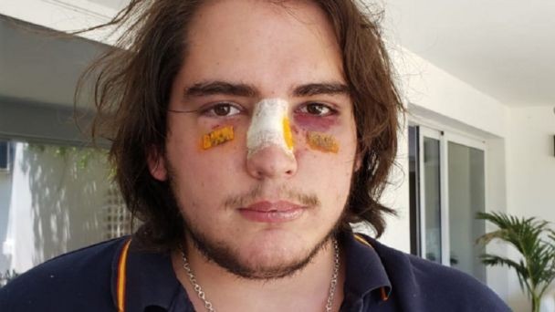 El comunicado de la UAR sobre los rugbiers acusados por la golpiza a un joven en Córdoba | Deportes