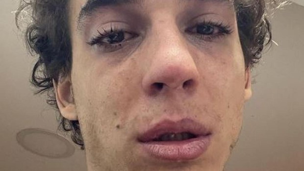 Preocupación por la confesión de uno de los actores de La casa de papel: "Ya no quiero hablar, ni comer" | Espectáculos