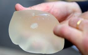 Confirman responsabilidad de certificador alemán en prótesis fraudulentas PIP | Internacionales