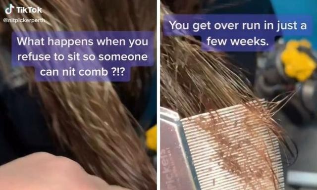 Video de terror: le pasó el peine fino a su hijo y lo sacó repleto de piojos | Tecnología