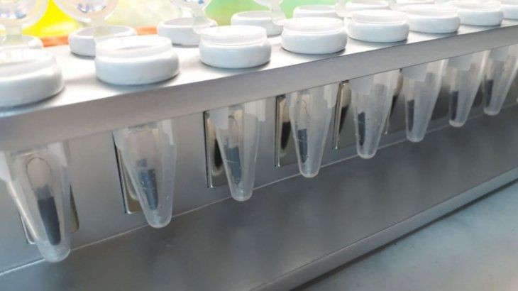 Coronavirus: científicos argentinos desarrollan un kit que acelera los testeos | Información General