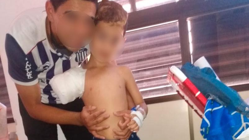 Un nene de 6 años perdió el brazo tras meterlo en el secarropas | Información General