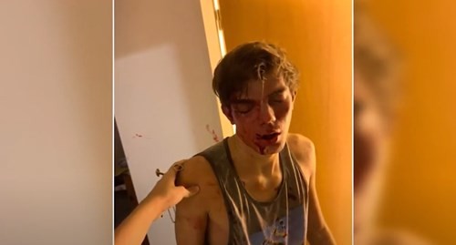 Eran conocidos, le robaron la llave y entraron a robar: su amigo fue desfigurado | Información General