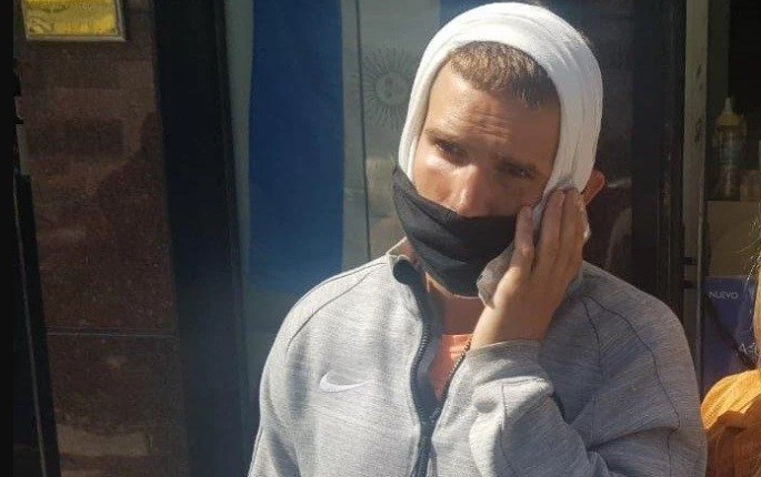 Denunció que le dieron una paliza en un boliche: "Eran seis patovicas contra mi" | Información General