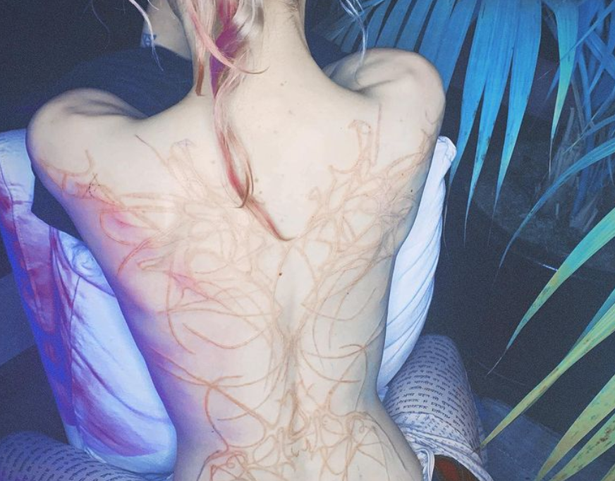 La novia de Elon Musk presumió sus impresionantes "cicatrices alienígenas" | Tecnología