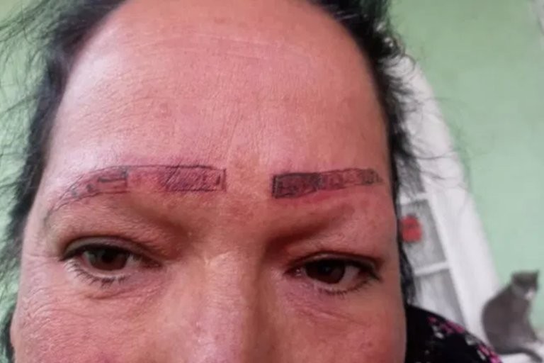 Se viralizó la denuncia de una joven por tatuadores que la estafaron y le arruinaron la cara | Tecnología