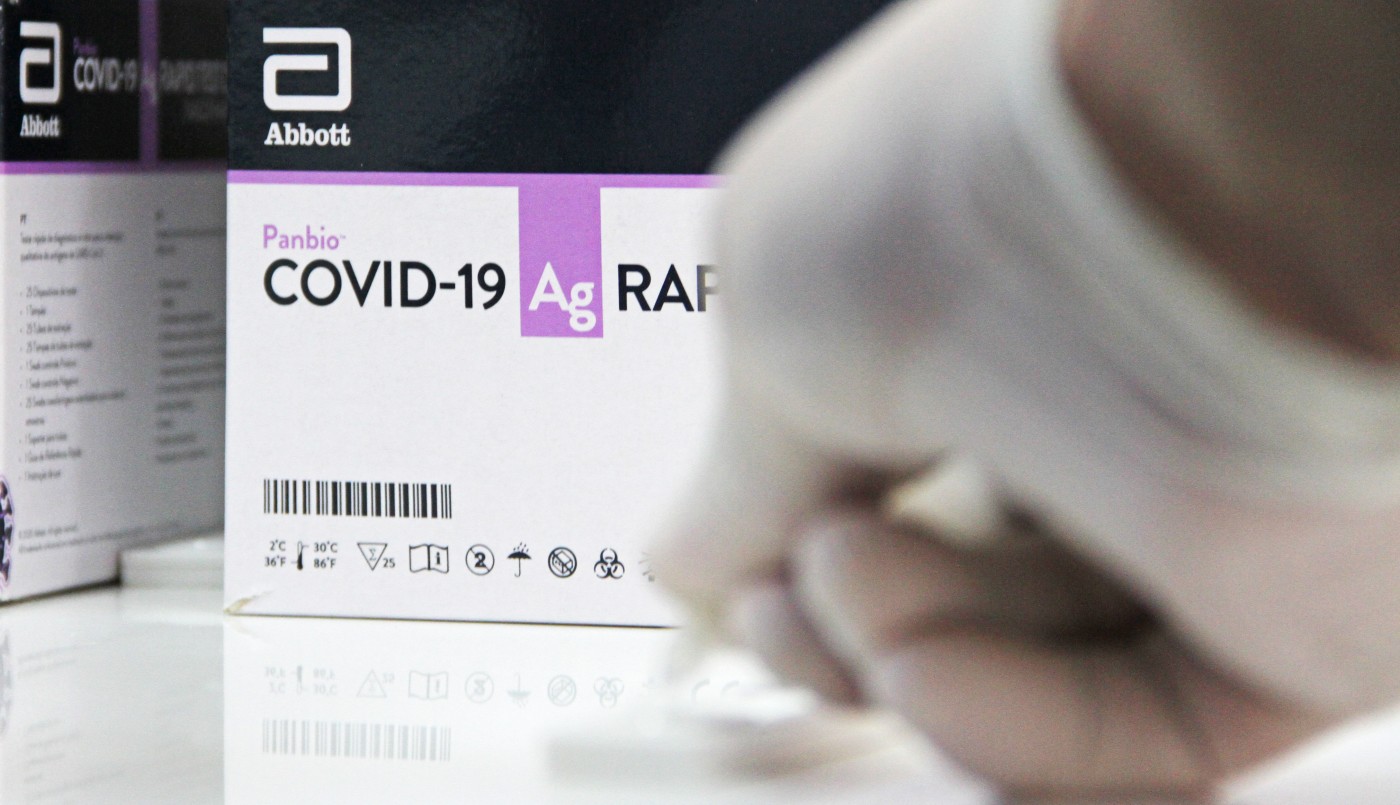 Covid-19: la provincia brindó recomendaciones para el uso de test de antígenos | Servicios