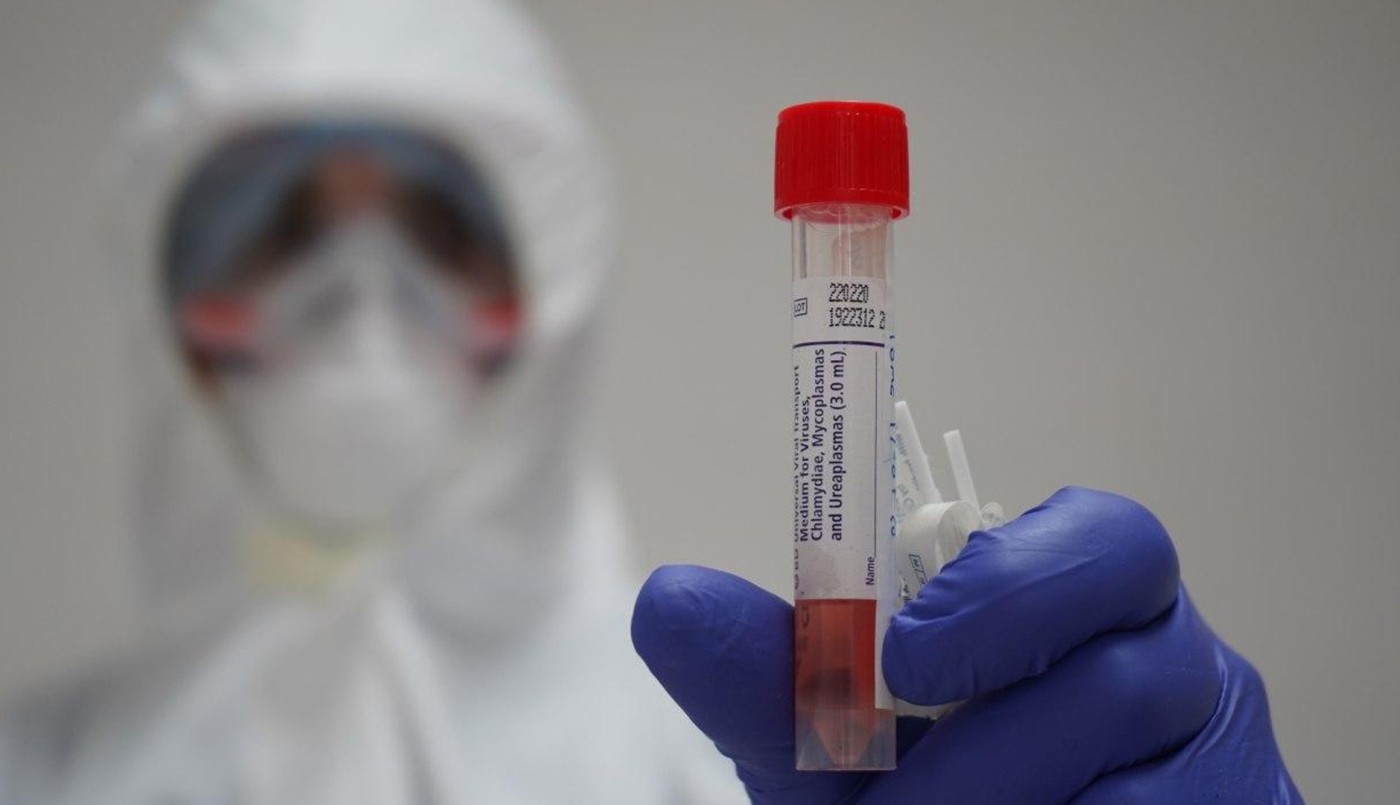 Rosario sumó este sábado 463 nuevos casos de coronavirus | Rosario y la región