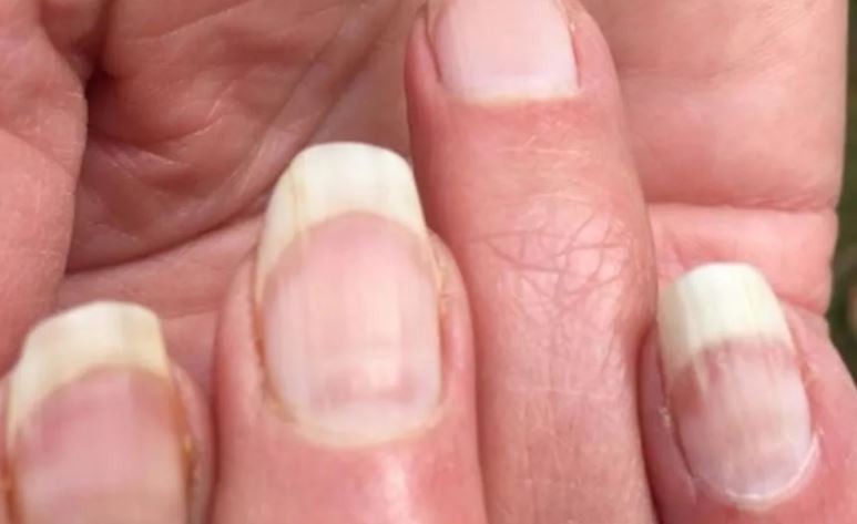 En las uñas se puede detectar si alguien tuvo coronavirus asintomático | Información General