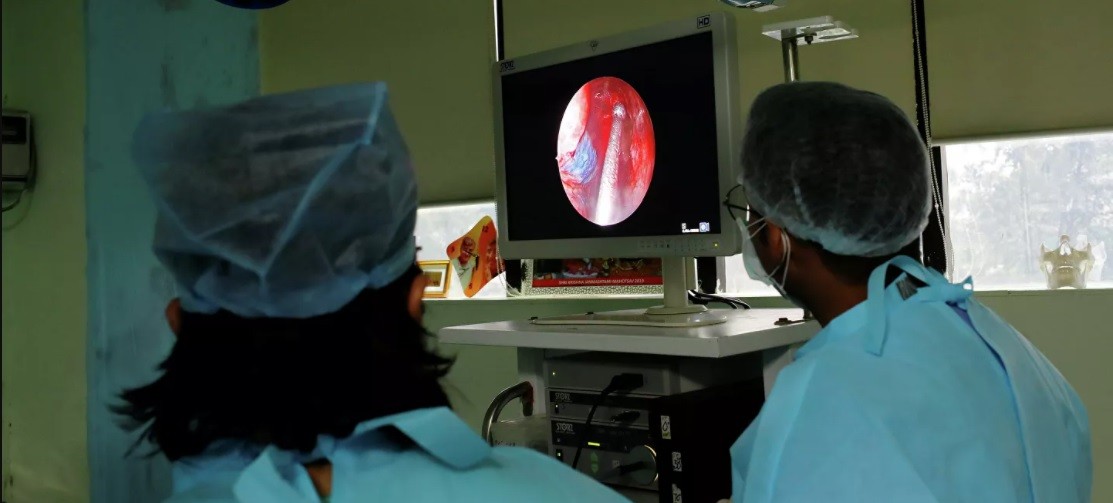 Alerta en Brasil por el primer caso de "hongo negro" en Brasil en un paciente con covid | Internacionales