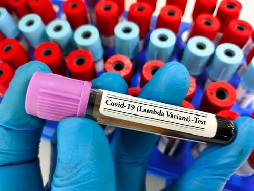 La variante Lambda del coronavirus empieza a emerger en Estados Unidos | Internacionales