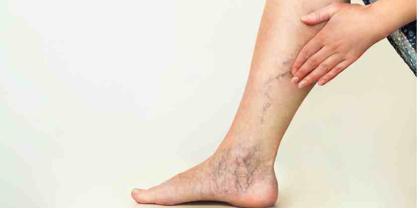 Estiman que el 30% de los casos de Covid padecen complicaciones vinculadas a la trombosis | Información General