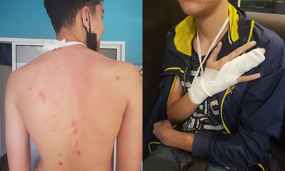 Brutal agresión a un alumno de una escuela privada de Fisherton | Rosario y la región