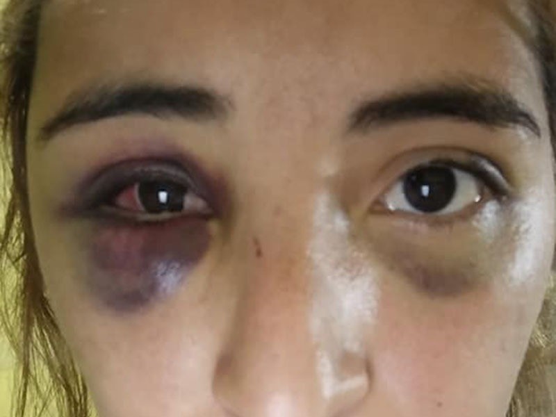 Sobrevivió a una brutal paliza de su ex pareja, que permanece prófugo | Rosario y la región