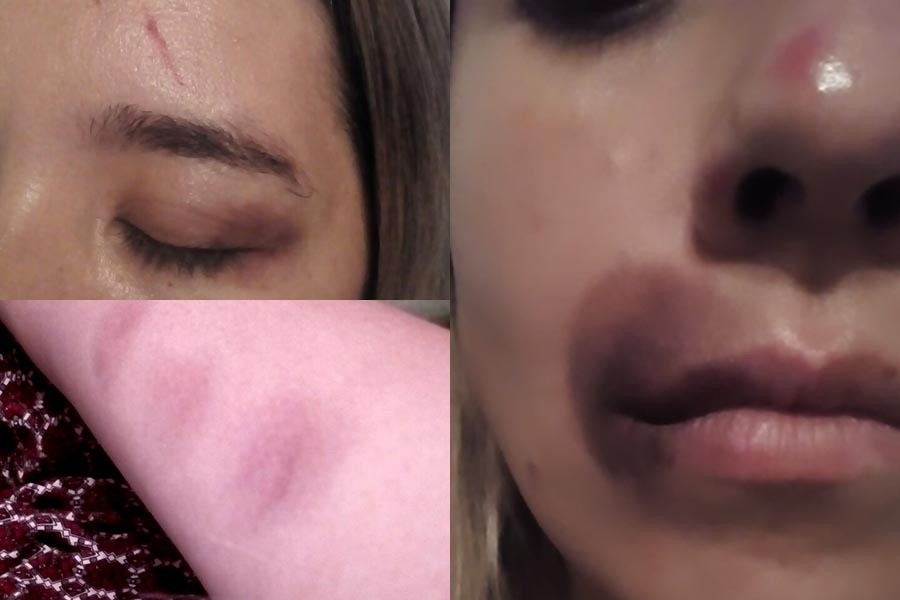 Ataque de odio: brutal golpiza a ex candidata a jefa comunal de la región | Rosario y la región