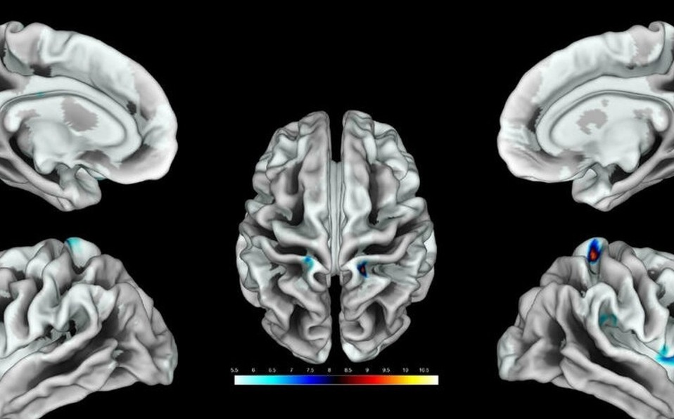 Fin del misterio: científicos identificaron el área del cerebro que corresponde al clítoris | Tecnología