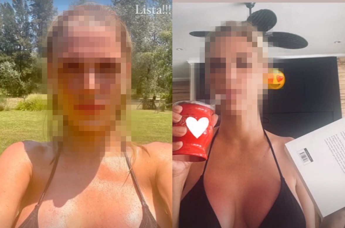 La nueva cara de Viviana Canosa: ¿lifting o filtro de Instagram? | Espectáculos