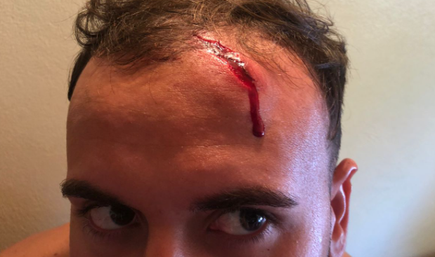 Mapuches atacaron con boleadoras y piedras a turistas que intentaron esquivar un corte en la ruta | Información General