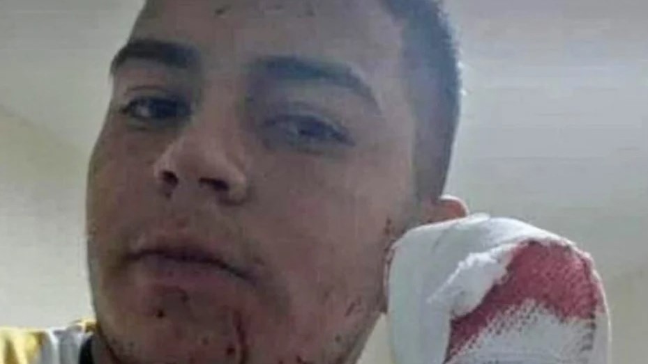 Dictaron prisión preventiva para el acusado de cortarle cuatro dedos a un delivery | Información General