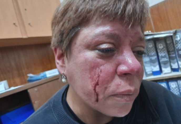 Una inspectora fue agredida en La Plata por los dueños de una hamburguesería | Información General