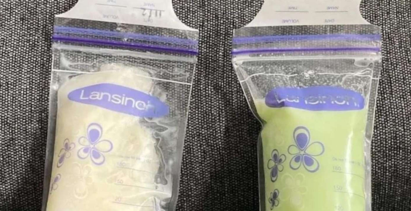 ¿Leche verde? El extraño síntoma que padecen algunas madres lactantes luego de contagiarse con Ómicron | Internacionales