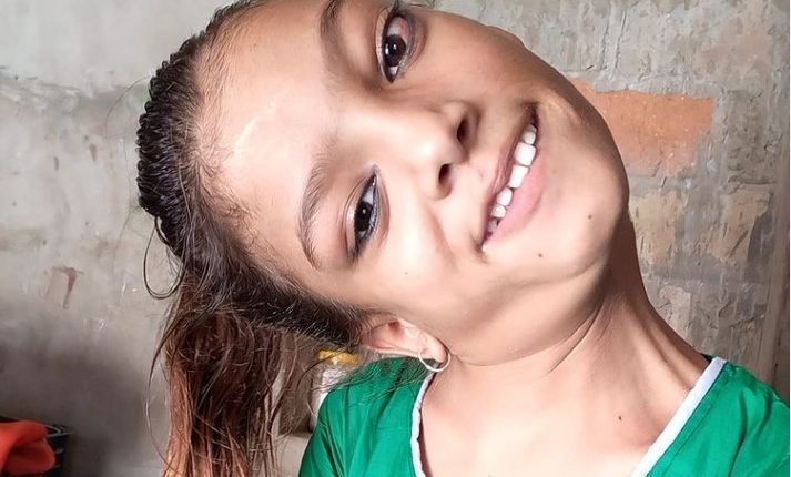 La “nueva vida” que tendrá una chica que estuvo 13 años con la cabeza en un ángulo de 90 grados | Tecnología