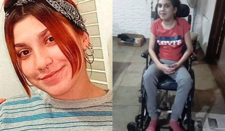 El calvario de Mili: su novio intentó matarla a golpes con una pala, sobrevivió y hoy lucha por recuperarse | Información General