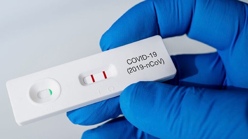 Dos mil autotest de coronavirus son vendidos por día en farmacias de todo el país | Información General