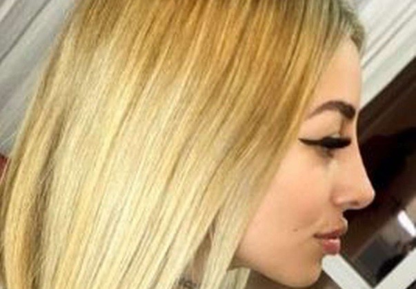 "Quedé como quería": Tamara Baéz, la novia de L-Gante, se realizó otro retoque estético | Espectáculos