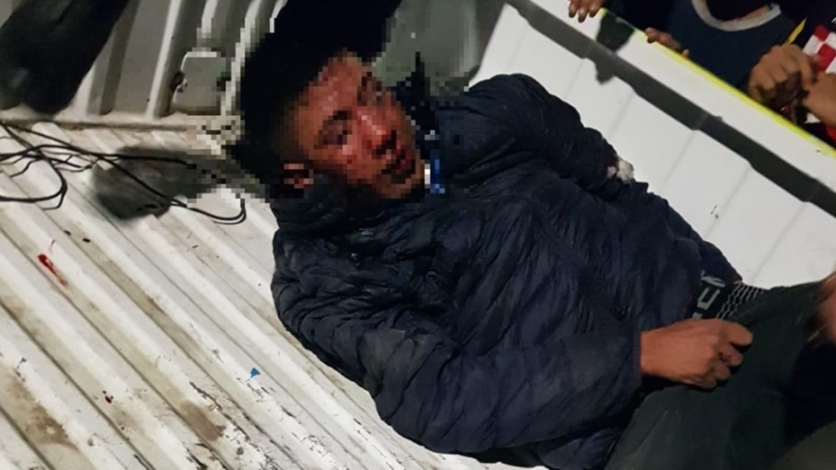 Hartos de la inseguridad, vecinos lincharon y le amputaron dos dedos a un ladrón | Información General