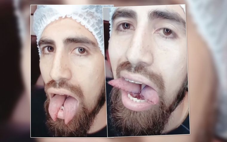 El ex jugador de Boca que se hizo una lengua bífida para parecer una serpiente | Información General
