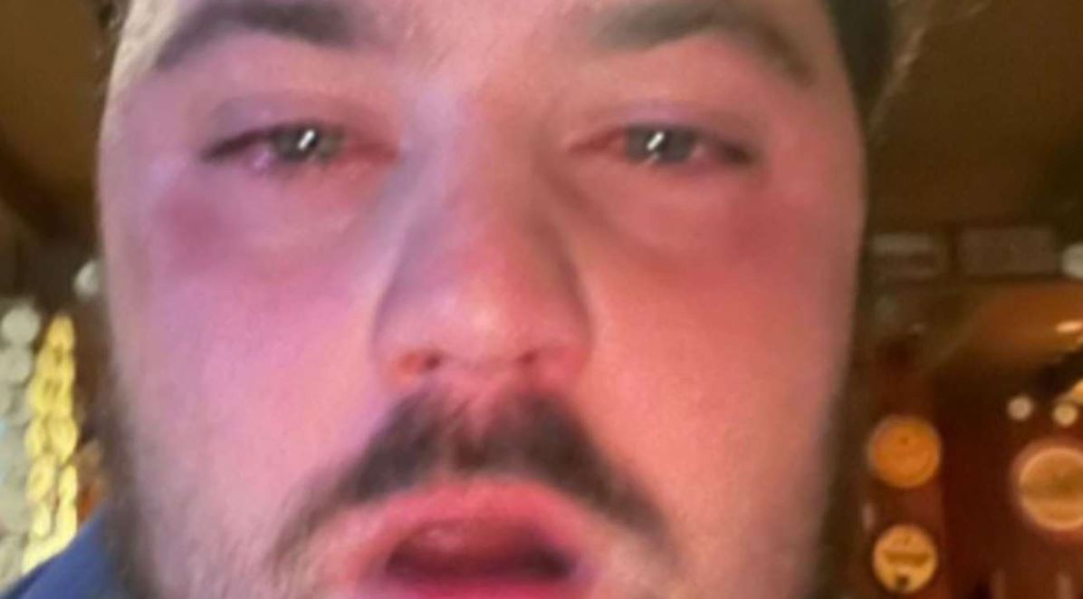 Atacó con gas pimienta al empleado de una cervecería y se fue sin pagar | Información General